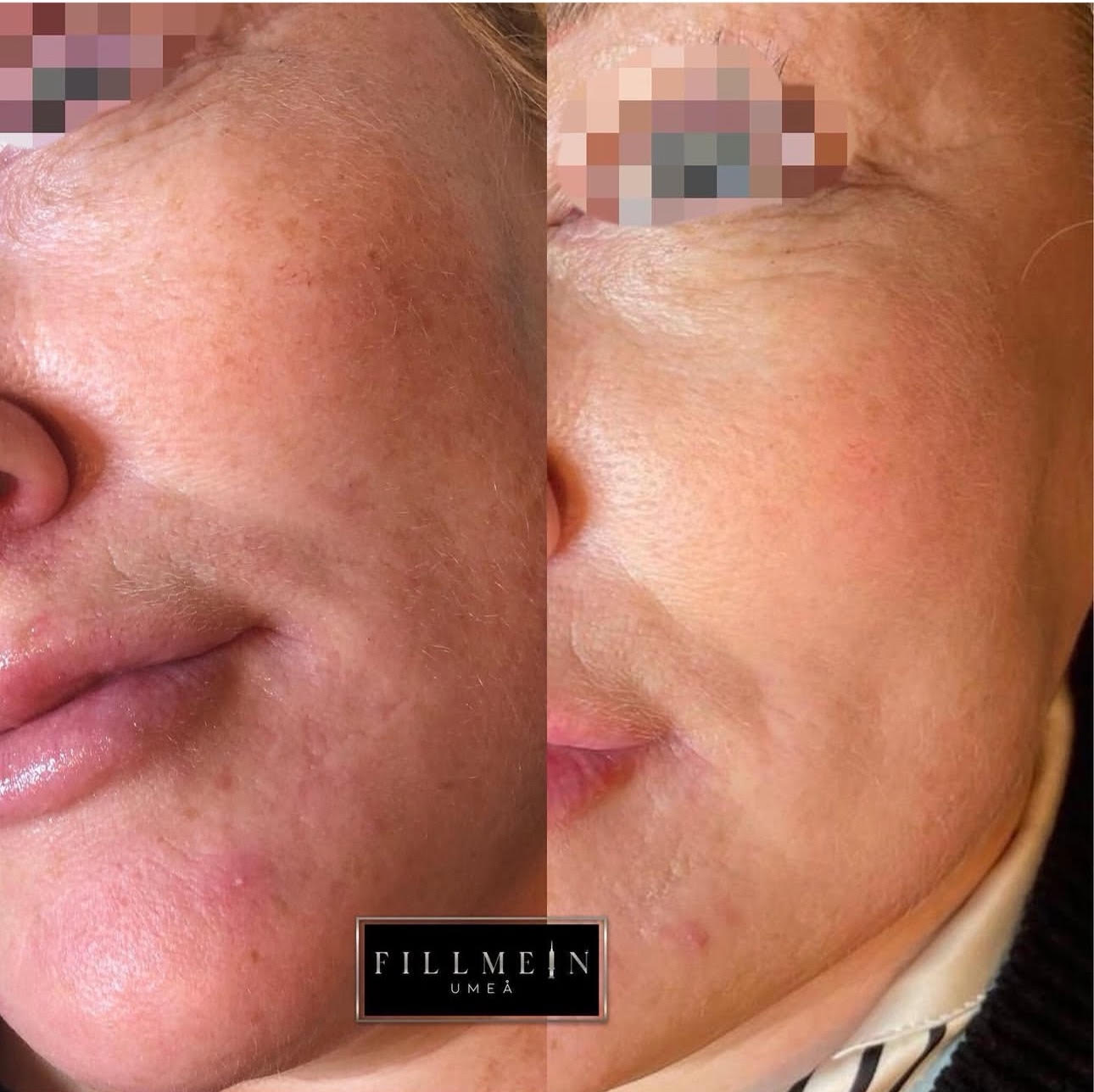 Skinbooster